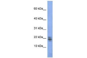 WB Suggested Anti-RNASE1 Antibody Titration:  0. (RNASE1 anticorps  (Middle Region))