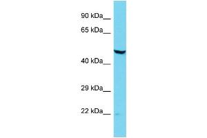 Host: Rabbit Target Name: DCAF12L2 Sample Type: Jurkat Whole Cell lysates Antibody Dilution: 1. (DCAF12L2 anticorps  (N-Term))