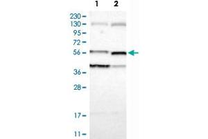 Western Blot analysis of Lane 1: RT-4 and Lane 2: U-251MG sp cell lysates with VIL1 polyclonal antibody . (Villin 1 anticorps)