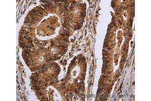 Immunohistochemistry of Human brain  using EXTL3 Polyclonal Antibody at dilution of 1:30 (EXTL3 anticorps)