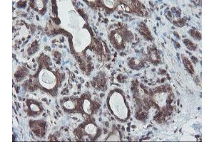 Image no. 4 for anti-SKI-Like Oncogene (SKIL) (AA 307-684) antibody (ABIN1491380)