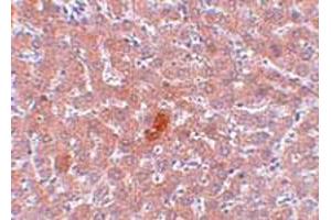 Immunohistochemical staining of rat liver tissue with 5 ug/mL KDM3A polyclonal antibody . (KDM3A anticorps  (N-Term))