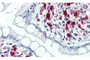 Detection of TREM2 in Human Small Intestine Tissue using Polyclonal Antibody to Triggering Receptor Expressed On Myeloid Cells 2 (TREM2)