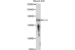 Western blot analysis of extracts of mouse liver, using FLT4 antibody. (FLT4 anticorps)