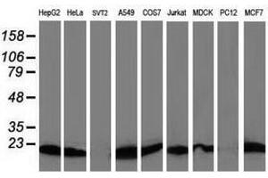 Image no. 4 for anti-Destrin (Actin Depolymerizing Factor) (DSTN) antibody (ABIN1497908)