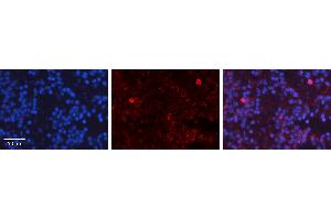 Rabbit Anti-TP53 Antibody   Formalin Fixed Paraffin Embedded Tissue: Human Lymph Node Tissue Observed Staining: Nucleus, Cytoplasm Primary Antibody Concentration: 1:100 Other Working Concentrations: 1:600 Secondary Antibody: Donkey anti-Rabbit-Cy3 Secondary Antibody Concentration: 1:200 Magnification: 20X Exposure Time: 0.