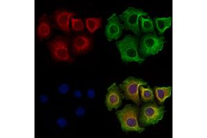CCDC28A Antibody staining Hela cells by IF/ICC. (CCDC28A anticorps  (Internal Region))