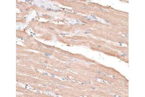 Immunohistochemistry of paraffin-embedded Rat heart using KIF14 Polyclonal Antibody at dilution of 1:100 (40x lens).