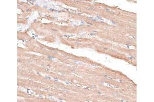 Immunohistochemistry of paraffin-embedded Rat heart using KIF14 Polyclonal Antibody at dilution of 1:100 (40x lens). (KIF14 anticorps)