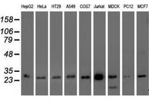 Western blot analysis of extracts (35 µg) from 9 different cell lines by using anti-OTUB2 monoclonal antibody. (OTUB2 anticorps)