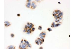 IHC testing of FFPE human MCF7 cells with ERAB antibody.