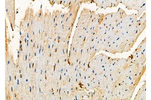 ABIN6257390 and ABIN6273800 at 1/100 staining Mouse heart tissue by IHC-P. (NRK anticorps  (N-Term))