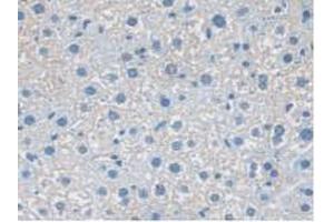 IHC-P analysis of Mouse Liver Tissue, with DAB staining. (NXN anticorps  (AA 167-435))