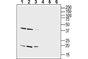 Western blot analysis of rat brain lysate (lanes 1 and 4), mouse brain lysate (lanes 2 and 5) and mouse liver lysate (lanes 3 and 6):1-3. (CD81 anticorps  (Extracellular))