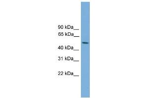 WB Suggested Anti-STK38L Antibody Titration: 0. (STK38L anticorps  (Middle Region))