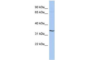 WB Suggested Anti-RNF113B Antibody Titration:  0. (RNF113B anticorps  (Middle Region))