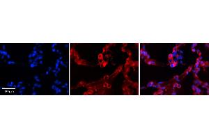 GPAA1 antibody - C-terminal region          Formalin Fixed Paraffin Embedded Tissue:  Human Lung Tissue    Observed Staining:  Cytoplasm of pneumocytes   Primary Antibody Concentration:  1:100    Other Working Concentrations:  1/600    Secondary Antibody:  Donkey anti-Rabbit-Cy3    Secondary Antibody Concentration:  1:200    Magnification:  20X    Exposure Time:  0. (GPAA1 anticorps  (C-Term))