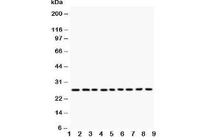 Western blot testing of Kallikrein 6 antibody and Lane 1:  MCF-7;  2: HeLa;  3: MM231;  4: MM453;  5: A549;  6: SMMC-7721;  7: COLO320;  8: SW620;  9: HT1080 (Kallikrein 6 anticorps  (C-Term))