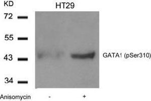 Image no. 2 for anti-GATA Binding Protein 1 (Globin Transcription Factor 1) (GATA1) (pSer310) antibody (ABIN196686) (GATA1 anticorps  (pSer310))
