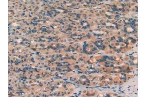 Figure. (SERPINA7 anticorps  (AA 114-391))