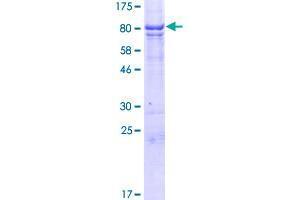 Image no. 1 for Family with Sequence Similarity 82, Member A2 (FAM82A2) (AA 1-470) protein (GST tag) (ABIN1353595)