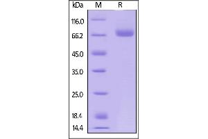 Human CD38, Fc Tag on  under reducing (R) condition.