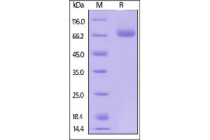 Human CD38, Fc Tag on  under reducing (R) condition. (CD38 Protein (AA 43-300) (Fc Tag))