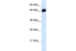 WB Suggested Anti-EIF2AK2 Antibody Titration:  0. (EIF2AK2 anticorps  (C-Term))