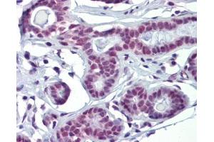 SOX4 antibody was used for immunohistochemistry at a concentration of 4-8 ug/ml.