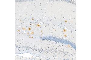 Immunohistochemistry analysis of paraffin embedded mouse Alzheimer',s brain using Aβ40 (ABIN7073042) at dilution of 1:400 (180x lens)