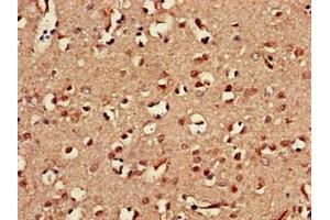 Immunohistochemistry of paraffin-embedded human brain tissue using ABIN7161085 at dilution of 1:100