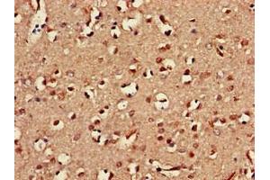 Immunohistochemistry of paraffin-embedded human brain tissue using ABIN7161085 at dilution of 1:100 (CD94 anticorps  (AA 42-168))