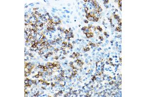 Immunohistochemistry of paraffin-embedded human tonsil using CD27 Rabbit pAb (ABIN3022680, ABIN3022681, ABIN3022682 and ABIN6219092) at dilution of 1:100 (40x lens). (CD27 anticorps  (AA 20-191))