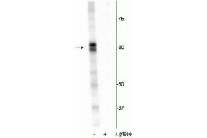 Western blot of Drosophila lysate showing specific immunolabeling of the ~60 kDa PRAS40 protein phosphorylated at Thr356 in the first lane (-). (PRAS40 anticorps  (pThr356))
