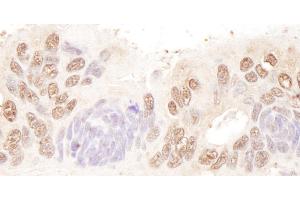 anti-BCL2-Associated Transcription Factor 1 (BCLAF1) (AA 300-350) antibody