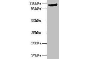 Western blot All lanes: MVP antibody at 2 μg/mL + Rat lung tissue Secondary Goat polyclonal to rabbit IgG at 1/10000 dilution Predicted band size: 100 kDa Observed band size: 110 kDa (MVP anticorps  (AA 2-893))