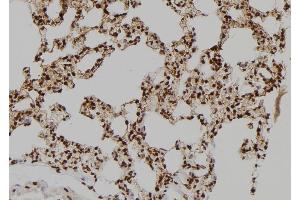 ABIN6275833 at 1/100 staining Rat lung tissue by IHC-P. (BAG4 anticorps  (Internal Region))