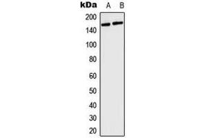 Western blot analysis of Collagen 4 alpha 5 expression in HeLa (A), mouse brain (B) whole cell lysates.