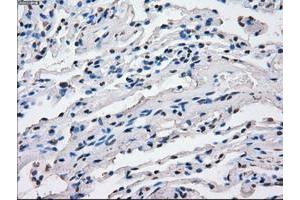 Image no. 6 for anti-Fc Fragment of IgG, Low Affinity IIa, Receptor (CD32) (FCGR2A) antibody (ABIN1497259)