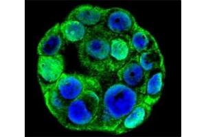 Confocal immunofluorescent analysis of SP1 antibody with WiDr cells followed by Alexa Fluor 488-conjugated goat anti-rabbit lgG (green).