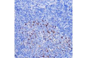 Immunohistochemistry of paraffin-embedded mouse spleen using NDUFB7 antibody (ABIN6132403, ABIN6144480, ABIN6144481 and ABIN6217781) at dilution of 1:100 (40x lens).