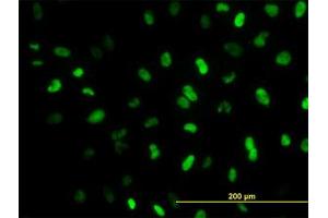 Image no. 5 for anti-Meis Homeobox 2 (MEIS2) (AA 1-382) antibody (ABIN598810) (MEIS2 anticorps  (AA 1-382))