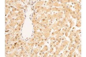 ABIN6267273 at 1/100 staining human liver tissue sections by IHC-P.
