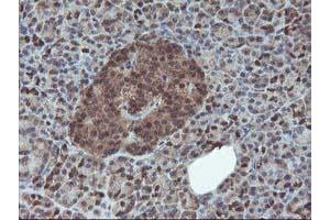 Image no. 1 for anti-Haloacid Dehalogenase-Like Hydrolase Domain Containing 1 (HDHD1) antibody (ABIN1498623) (HDHD1 anticorps)