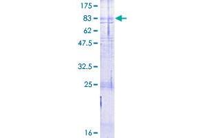 Image no. 1 for Calcitonin Receptor (CALCR) (AA 1-474) protein (GST tag) (ABIN1347876)