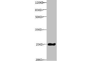 All lanes: Mouse anti-Human Timp1 monoclonal antibody at 1 μg/mL Lane 1: TIMP1 transfected pichia Yeast cell lysate Predicted band size : 23 kDa Observed band size:23 kDa (TIMP1 anticorps)