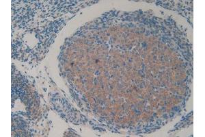 DAB staining on IHC-P; Samples: Mouse Ovary Tissue