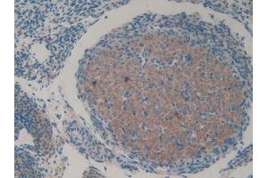 DAB staining on IHC-P; Samples: Mouse Ovary Tissue (HAP1 anticorps  (AA 132-328))