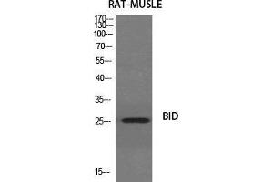 Western Blot (WB) analysis of specific cells using BID Polyclonal Antibody. (BID anticorps  (Ser179))
