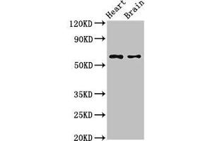 Western Blot Positive WB detected in: Mouse heart tissue, Mouse brain tissue All lanes: CYP3A4 antibody at 2.